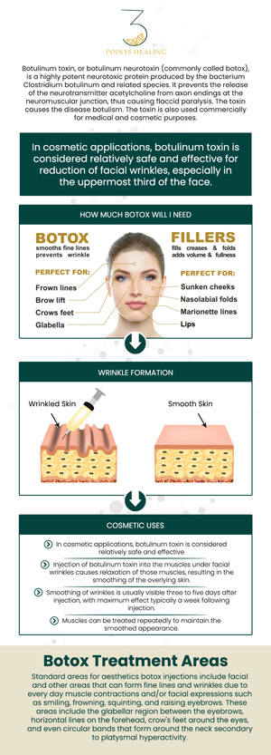 Enhance your natural beauty with Botox treatments at Three Points Healing, expertly administered by Dr. Mina Liu. These quick, effective procedures target fine lines and wrinkles, helping you achieve a smooth, youthful appearance. With minimal downtime and lasting results, Botox can help you look and feel your best. For more information, contact us or book an appointment. Our clinics are conveniently located in Olympia, WA, Federal Way, WA, and Woodland Hills, CA.